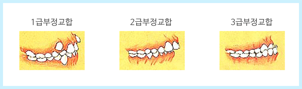 내부이미지