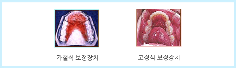 내부이미지