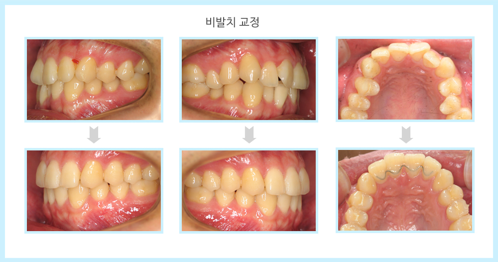 내부이미지