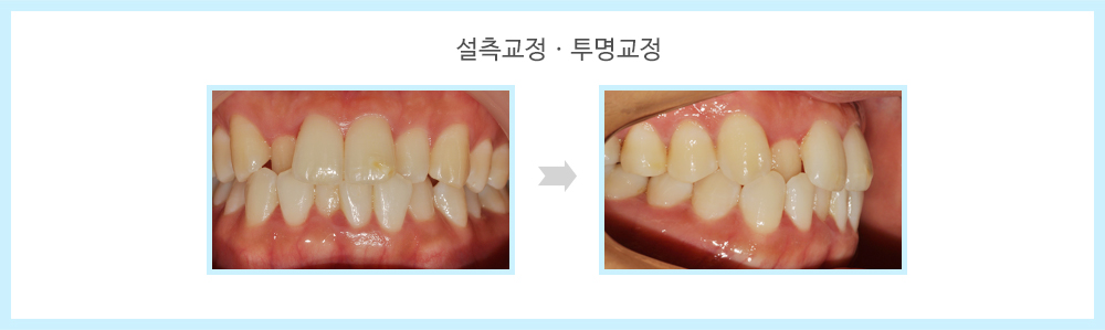 내부이미지