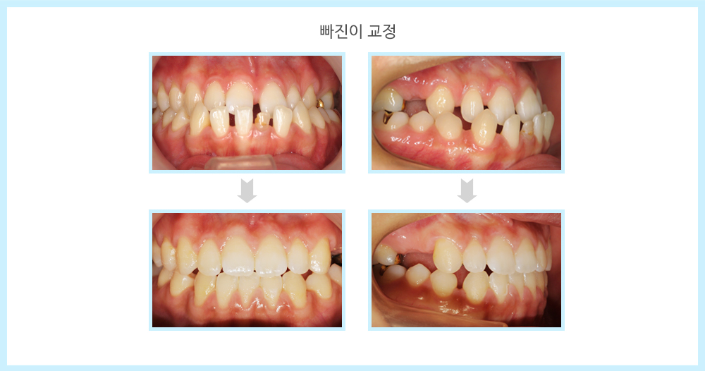 내부이미지