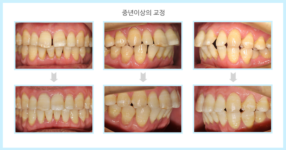 내부이미지