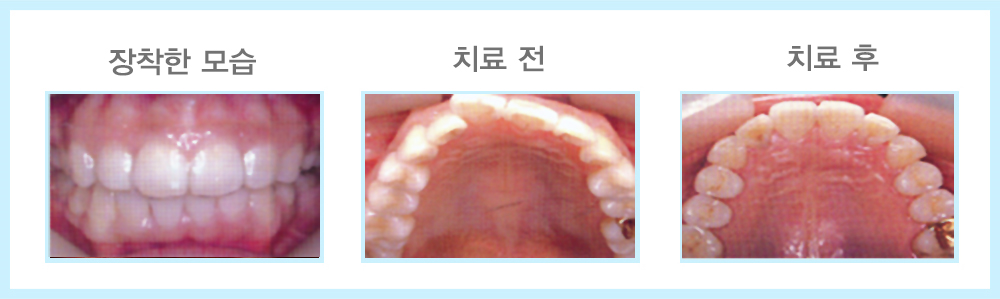 내부이미지