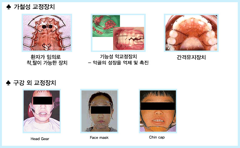 내부이미지
