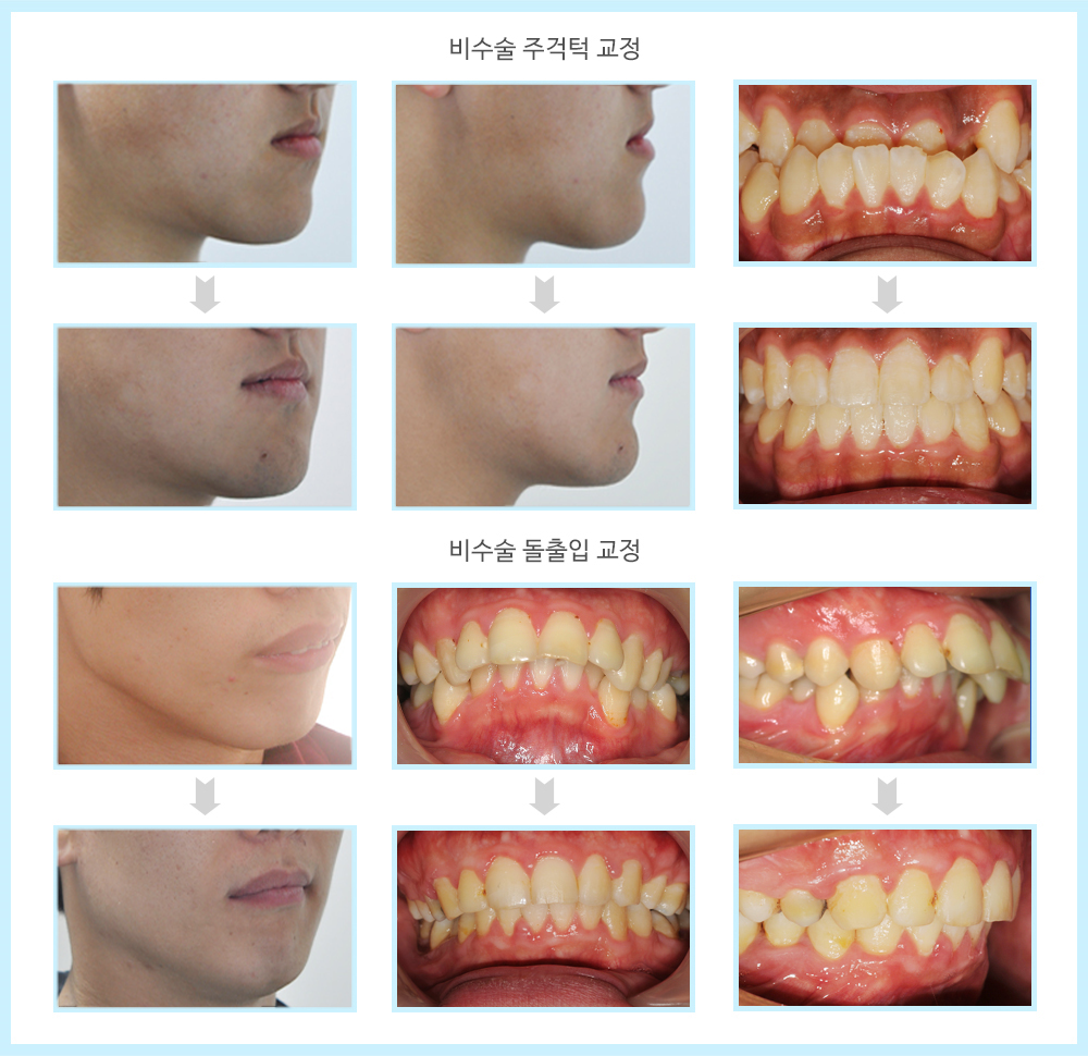 내부이미지