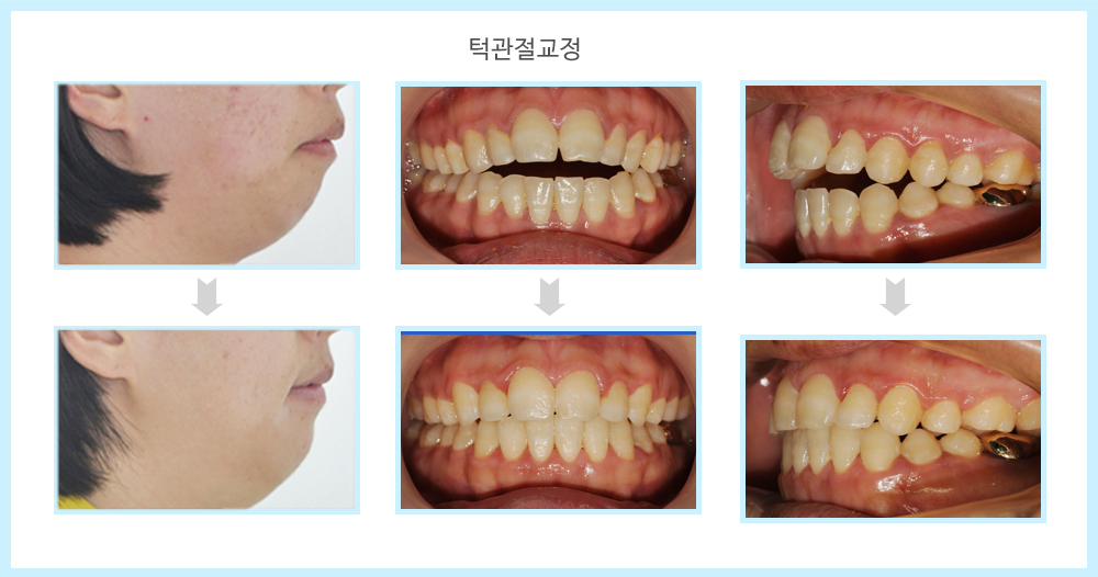내부이미지